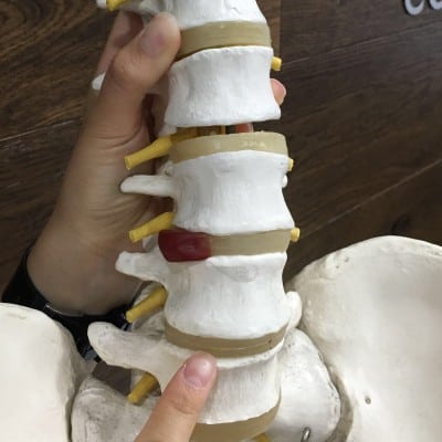 Lumbar Spine Disc