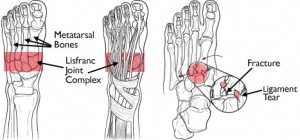 anatomy midfoot physiotherapy