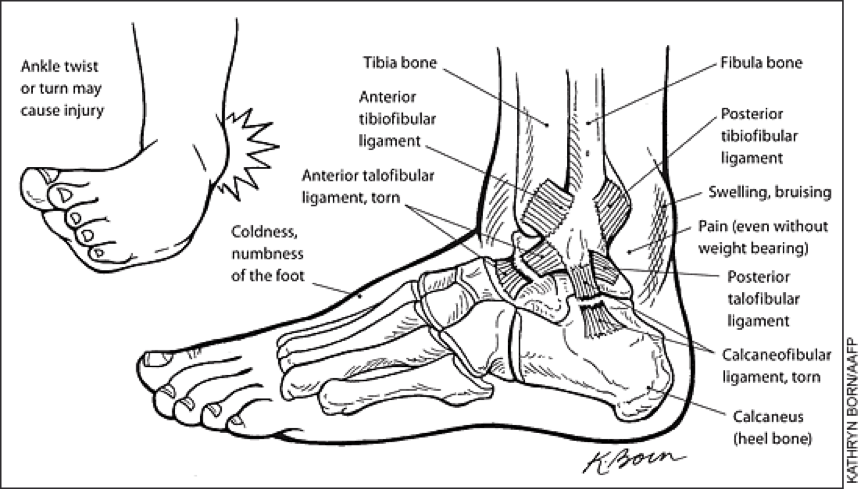 Ankle anatomy and ligament injury