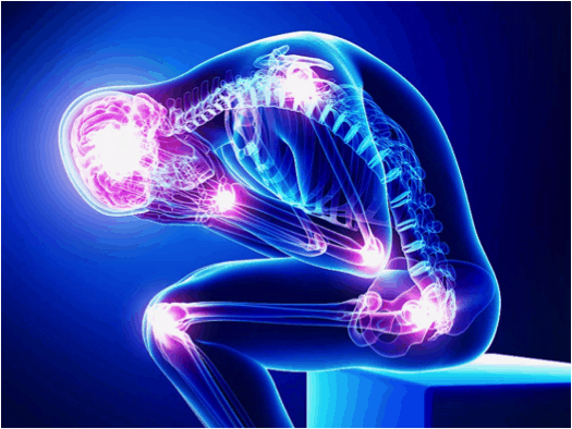 Chronic Pain and Physiotherapy