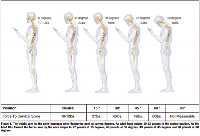 text neck pain posture skeleton
